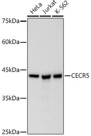 CECR5 Rabbit mAb