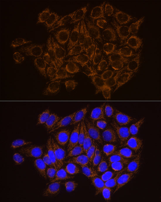 CECR5 Rabbit mAb