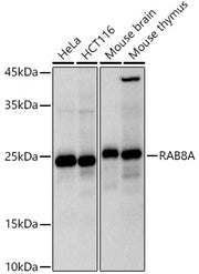 RAB8A Rabbit mAb