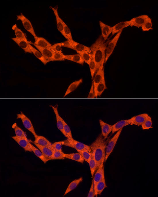 RAB8A Rabbit mAb