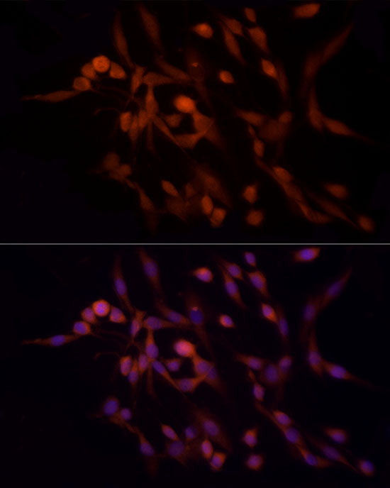 RAB8A Rabbit mAb