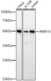 PRPF31 Rabbit mAb
