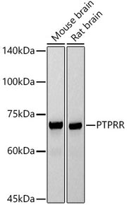 PTPRR Rabbit mAb