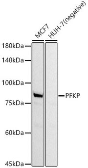 PFKP Rabbit mAb