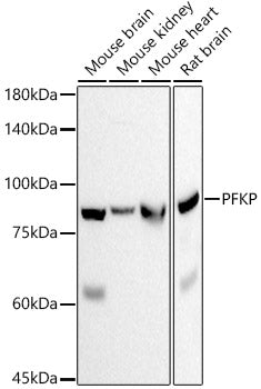 PFKP Rabbit mAb