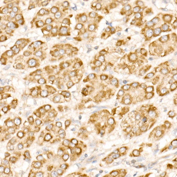 PFKP Rabbit mAb