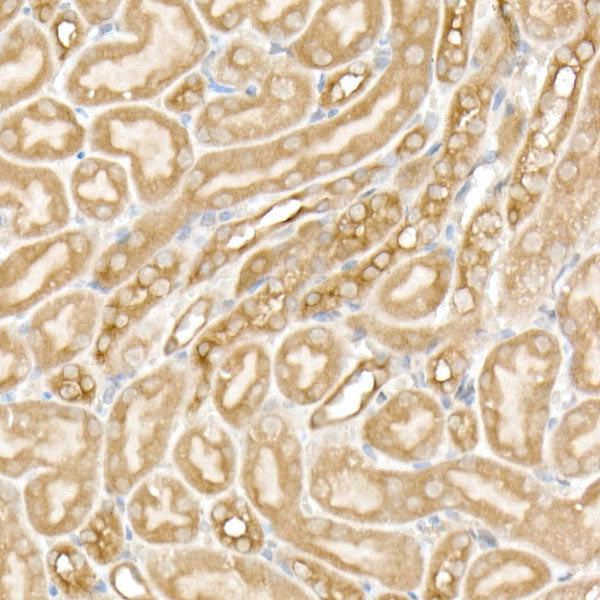 PFKP Rabbit mAb