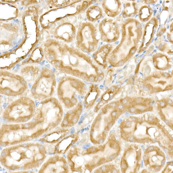PFKP Rabbit mAb