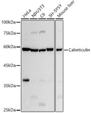 [KO Validated] Calreticulin Rabbit mAb