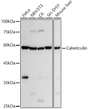 [KO Validated] Calreticulin Rabbit mAb