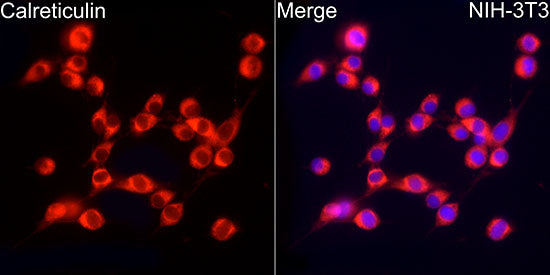 [KO Validated] Calreticulin Rabbit mAb