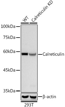 [KO Validated] Calreticulin Rabbit mAb