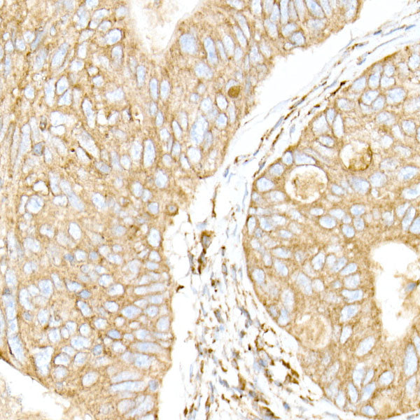 [KO Validated] Calreticulin Rabbit mAb