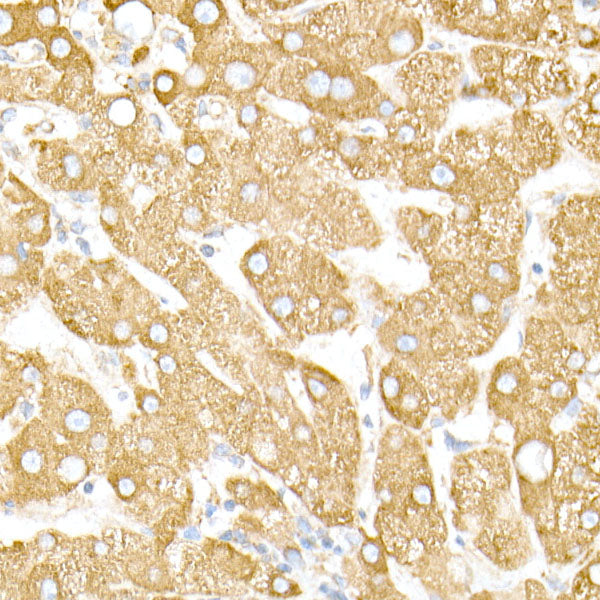 [KO Validated] Calreticulin Rabbit mAb