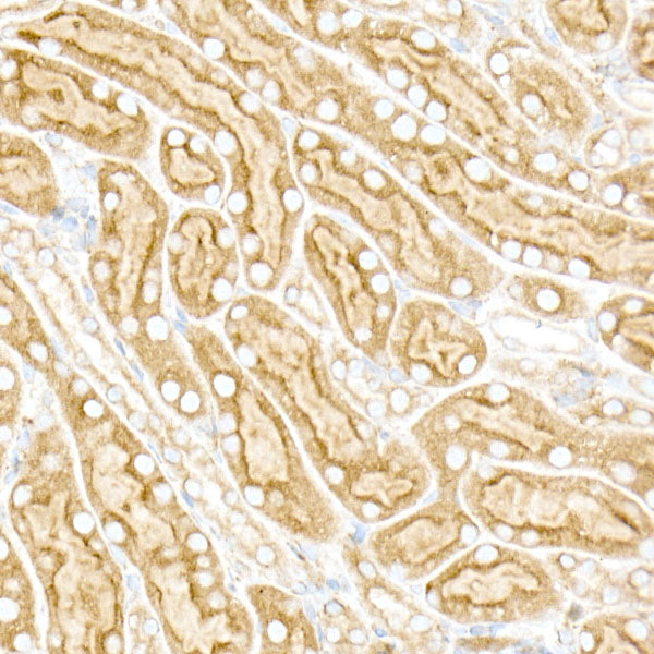 [KO Validated] Calreticulin Rabbit mAb