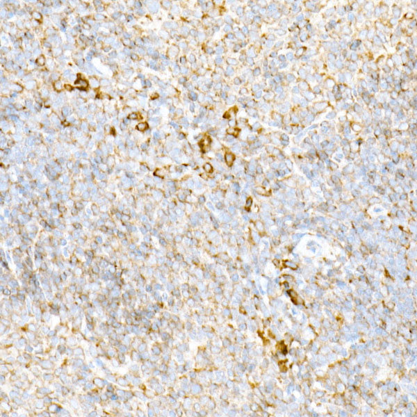 [KO Validated] Calreticulin Rabbit mAb