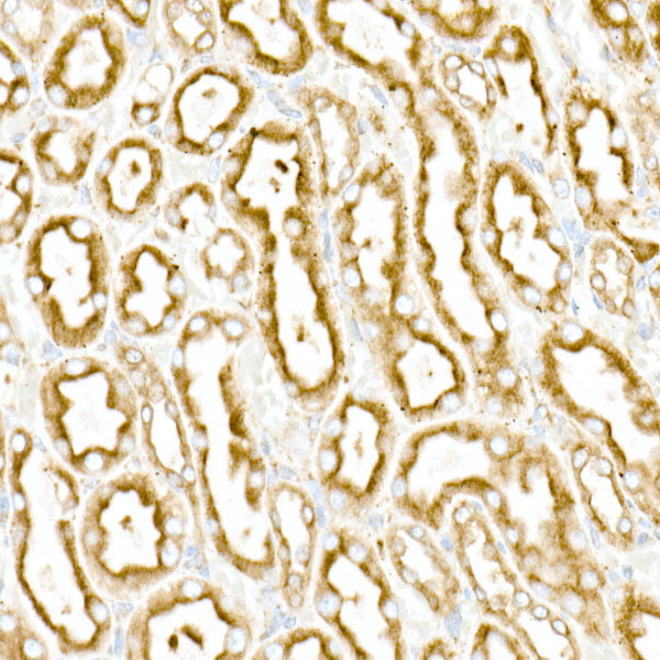 [KO Validated] Calreticulin Rabbit mAb