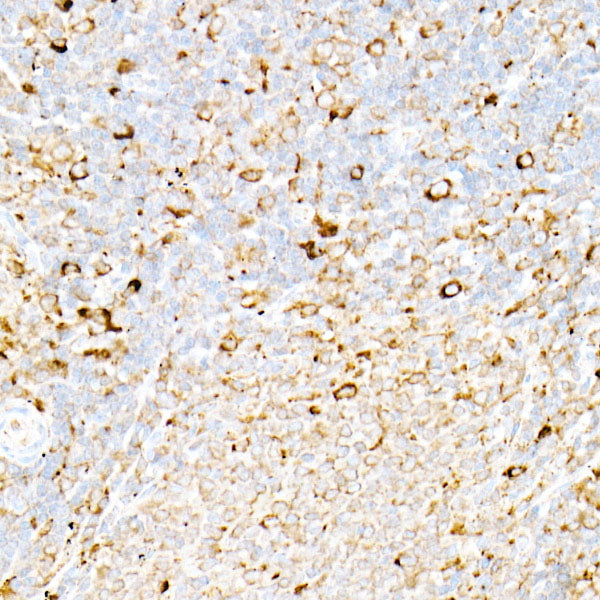 [KO Validated] Calreticulin Rabbit mAb