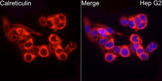 [KO Validated] Calreticulin Rabbit mAb