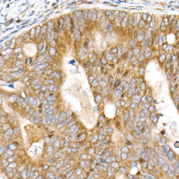 DDIT3/CHOP Rabbit mAb