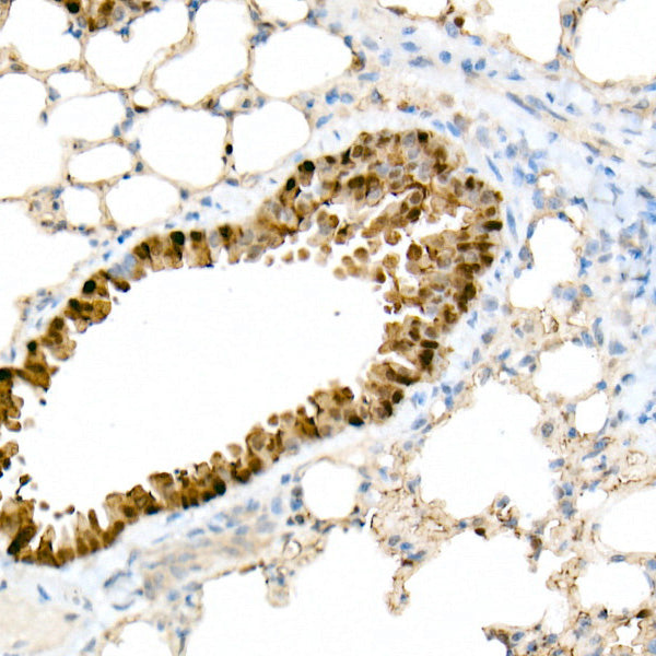 DDIT3/CHOP Rabbit mAb