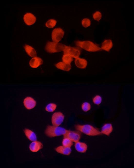 PKM2-specific Rabbit mAb