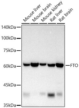 [KO Validated] FTO Rabbit mAb
