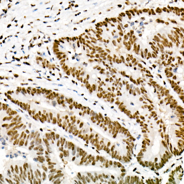 [KO Validated] FTO Rabbit mAb