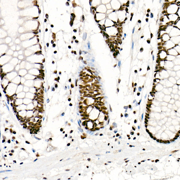 [KO Validated] FTO Rabbit mAb