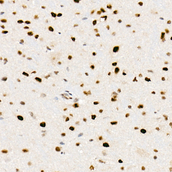 [KO Validated] FTO Rabbit mAb