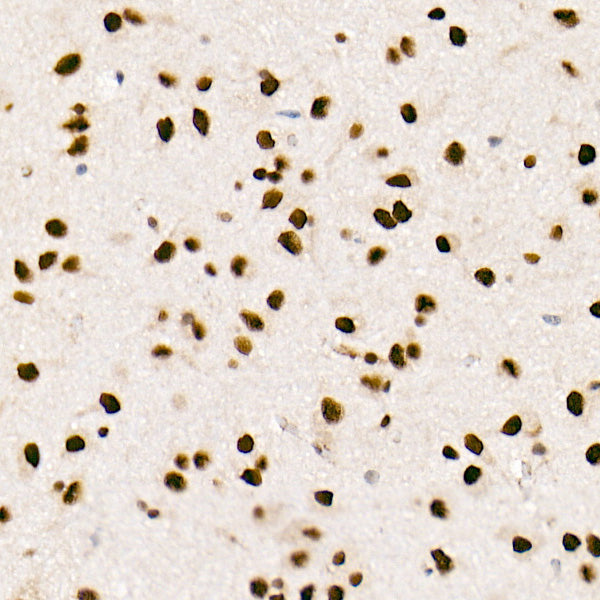 [KO Validated] FTO Rabbit mAb