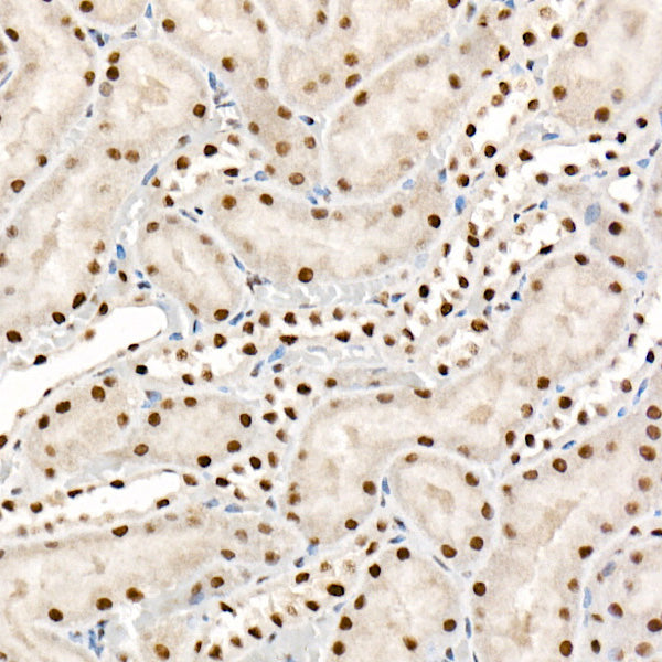 [KO Validated] FTO Rabbit mAb