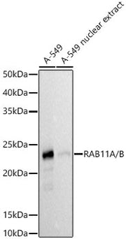 RAB11A/B Rabbit mAb