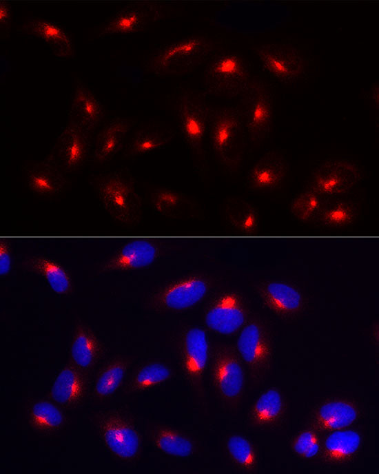 RAB11A/B Rabbit mAb