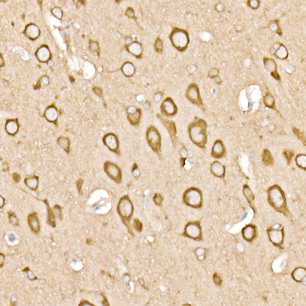 RAB11A/B Rabbit mAb