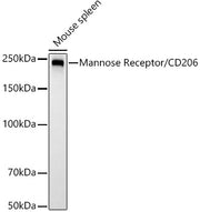 Mannose Receptor/CD206 Rabbit mAb