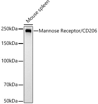 Mannose Receptor/CD206 Rabbit mAb