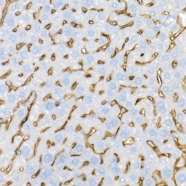 Mannose Receptor/CD206 Rabbit mAb