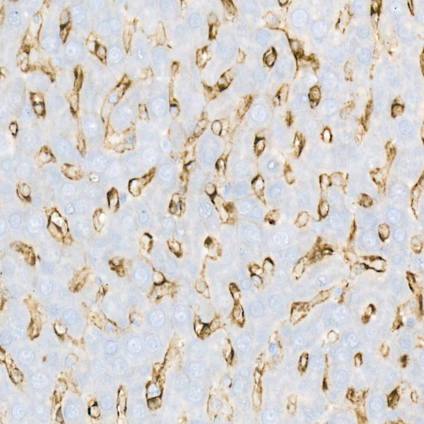 Mannose Receptor/CD206 Rabbit mAb