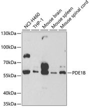 PDE1B Rabbit pAb