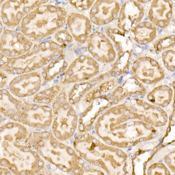 SDHC Rabbit pAb