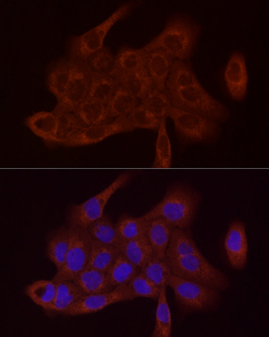 SDHC Rabbit pAb