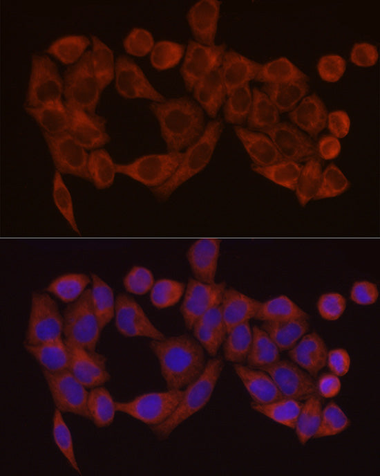 SDHC Rabbit pAb