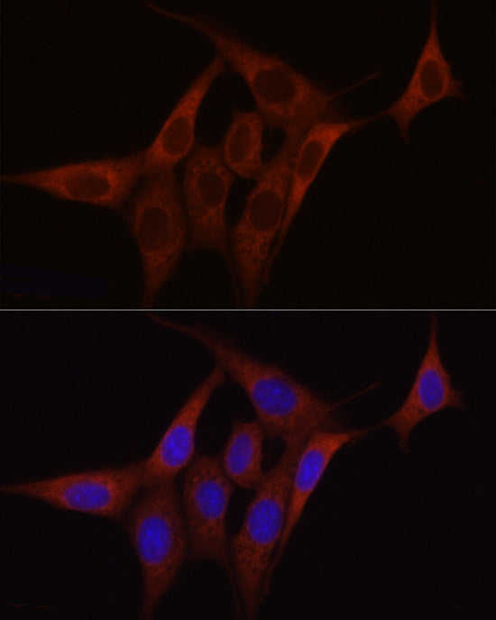 SDHC Rabbit pAb