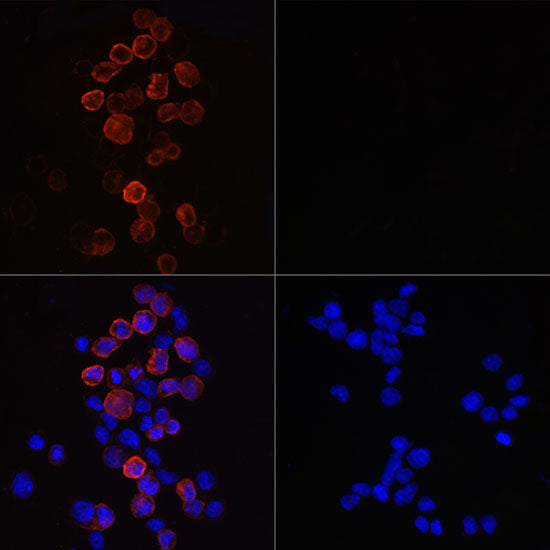 SARS-CoV-2 Nucleoprotein Rabbit mAb