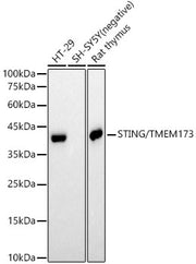 STING/TMEM173 Rabbit mAb