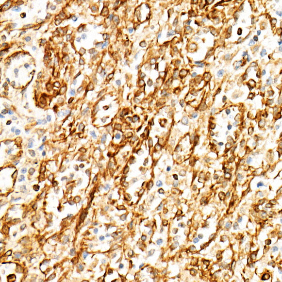 STING/TMEM173 Rabbit mAb