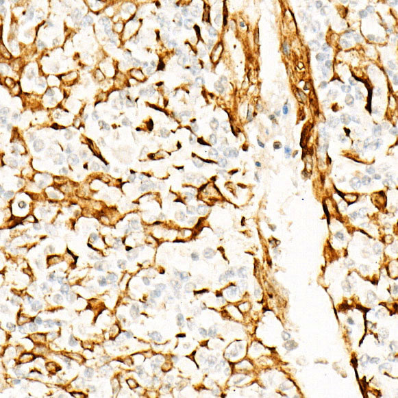 STING/TMEM173 Rabbit mAb