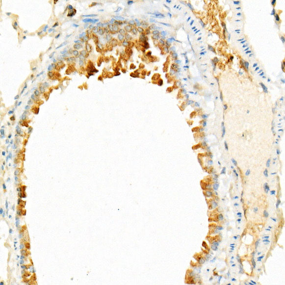 STING/TMEM173 Rabbit mAb