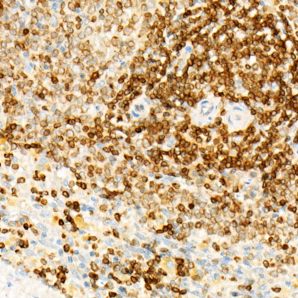 STING/TMEM173 Rabbit mAb